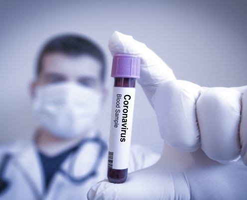 coronavirus-(covid-19)-:-le-point-(juridique)-sur-les-projets-de-recherche