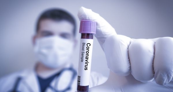 coronavirus-(covid-19)-:-du-nouveau-concernant-la-detection-du-coronavirus