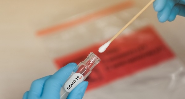 coronavirus-(covid-19)-:-tester-pour-identifier-les-variants