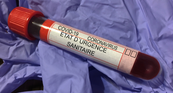 coronavirus-(covid-19)-:-l’etat-d’urgence-sanitaire-est-declare-en-martinique-et-a-la-reunion