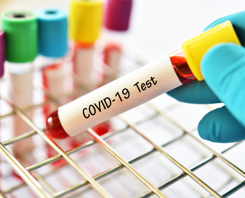 coronavirus-(covid-19)-:-combien-cela-coute-de-se-faire-tester-en-outre-mer-?