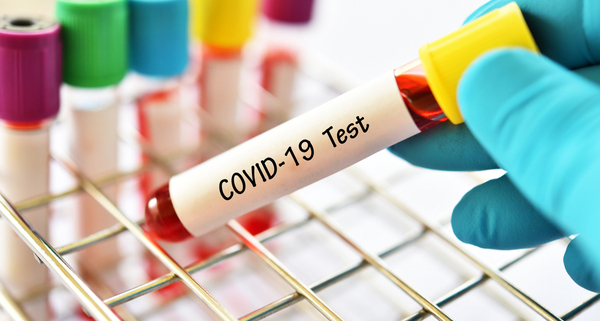 coronavirus-(covid-19)-:-combien-cela-coute-de-se-faire-tester-en-outre-mer-?