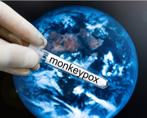 variole-du-singe-(monkeypox)-:-mobilisation-de-la-reserve-sanitaire-!