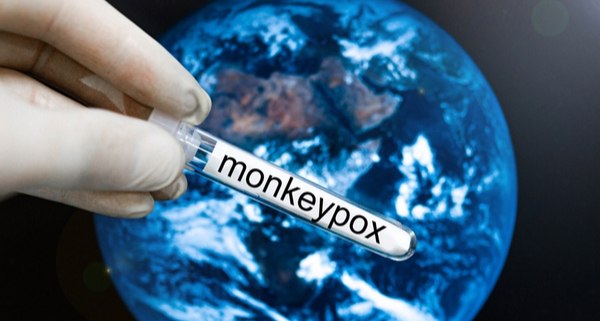 variole-du-singe-(monkeypox)-:-mobilisation-de-la-reserve-sanitaire-!